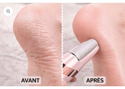Lime électrique rechargeable Anti-Callosités